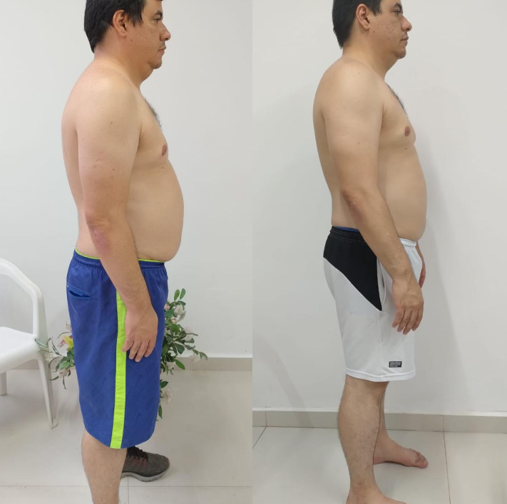 Antes e depois real do aluno Daniel