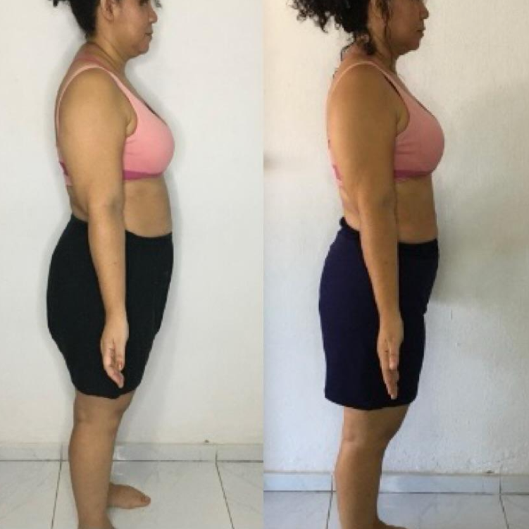 Antes e depois real da aluna Katia